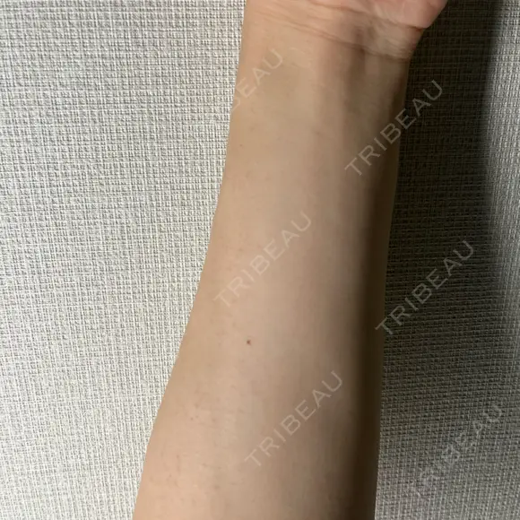 医療脱毛（顔） / 医療脱毛（全身） おおかみ美容のクリニック 横浜院 DAY 0 メイン用