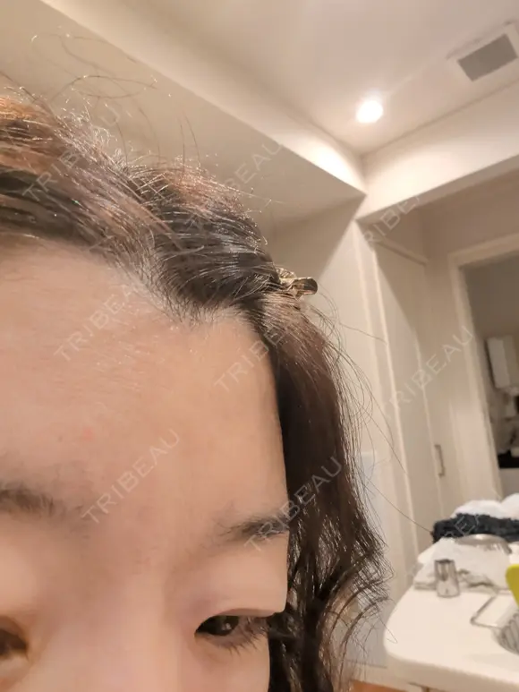 再生医療 A CLINIC（エークリニック） 新宿院 DAY 0 メイン用