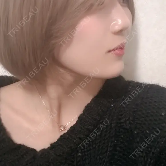 糸リフト / ボトックス（あご） / 肌ヒアルロン酸注入（たるみ・シワ改善） / ボトックス（ガミースマイル） ルラ美容クリニック 池袋院 DAY 1 メイン用