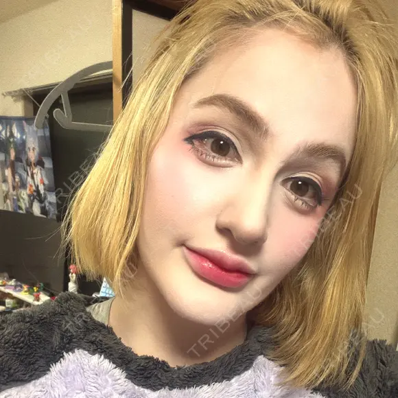 ヒアルロン酸注入（涙袋） / ヒアルロン酸注入（唇） ルラ美容クリニック 横浜院 AFTER メイン用