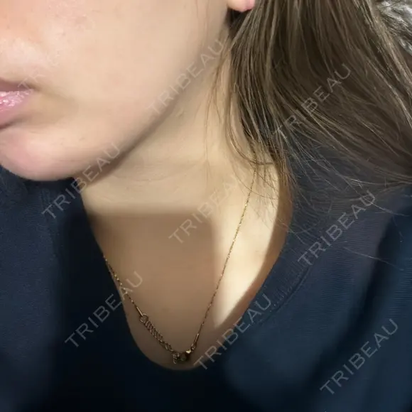 糸リフト / 脂肪吸引（顔） / 水光注射（ハリ・美肌） Wing clinic 豊中駅前院 AFTER メイン用