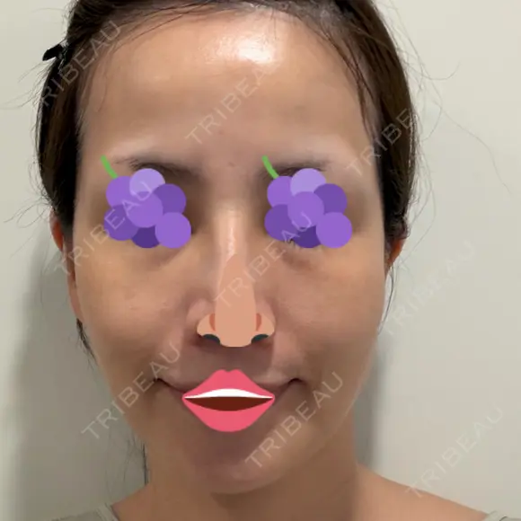 オリジオ PRISM Beauty Clinic 新宿院 DAY 17 メイン用