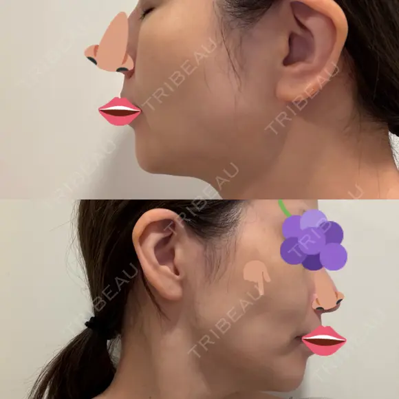 オリジオ PRISM Beauty Clinic 新宿院 DAY 17 メイン用