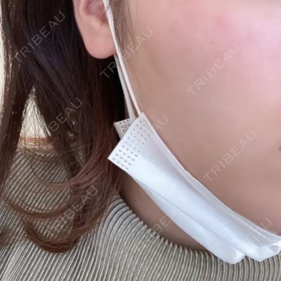 ルメッカ Moon Beauty Clinic AFTER メイン用