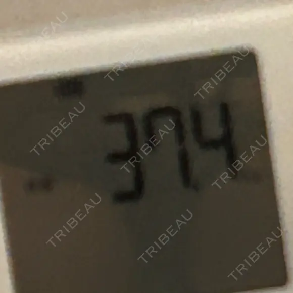 美容点滴・美容注射（ダイエット） 脂肪吸引ラボトウキョウ DAY 4 メイン用