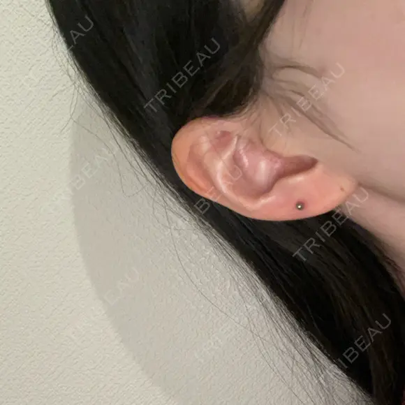 ピアス穴あけ 美容皮膚科エルムクリニック 京都院 DAY 0 メイン用