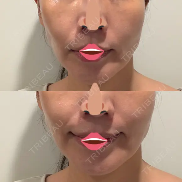 オリジオ PRISM Beauty Clinic 新宿院 AFTER メイン用