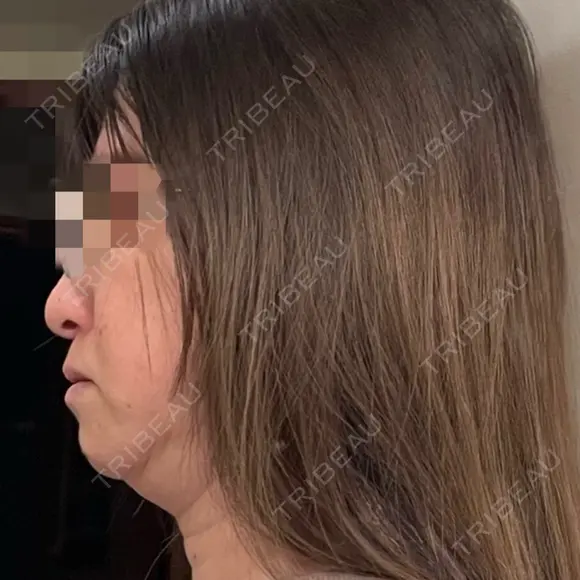 オンダリフト Wing clinic 豊中駅前院 AFTER メイン用