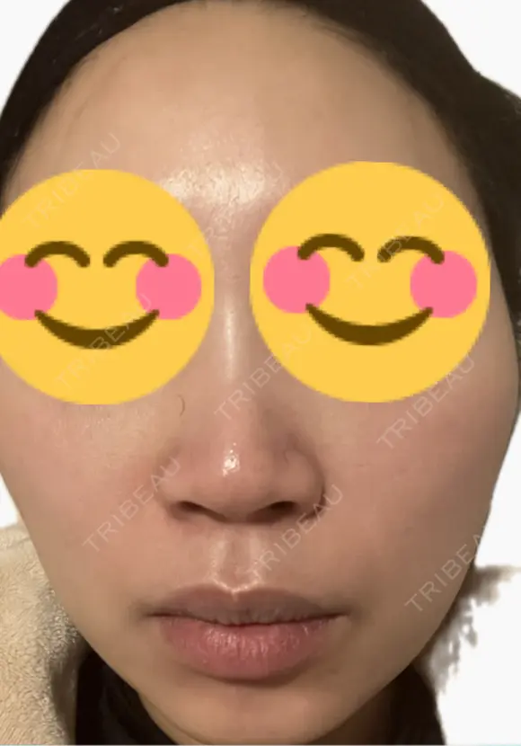 ルメッカ La Fee Clinic DAY 1 メイン用