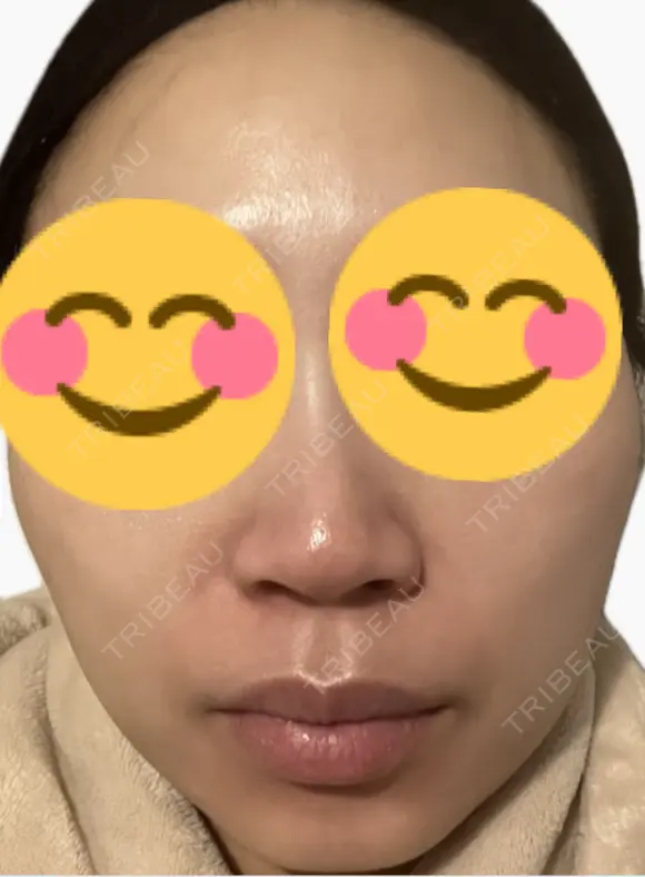 ルメッカ La Fee Clinic DAY 2 メイン用