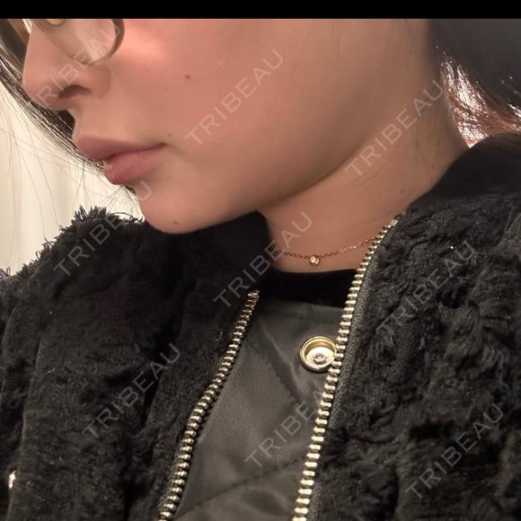 バッカルファット除去 / 脂肪吸引（顔） / あご下筋肉縛り セギム美容整形外科 DAY 31 メイン用