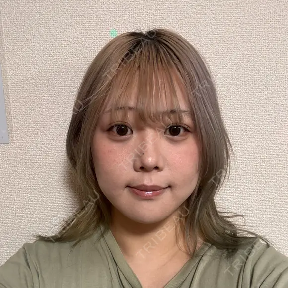 クマ治療 / 脂肪吸引（顔） 新宿美容外科ネビュラクリニック DAY 88 メイン用
