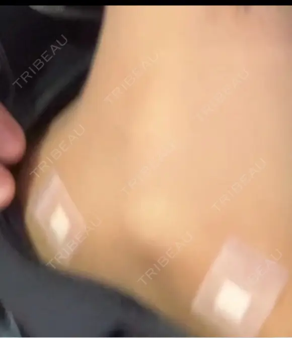 プラセンタ注射 タイムルクリニック AFTER メイン用