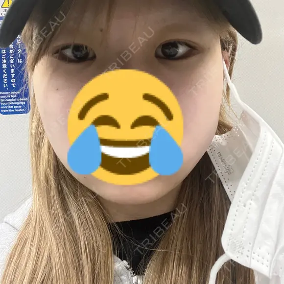 糸リフト / 脂肪吸引（顔） / ボトックス（エラ・小顔） PRISM Beauty Clinic 町田院 DAY 0 メイン用