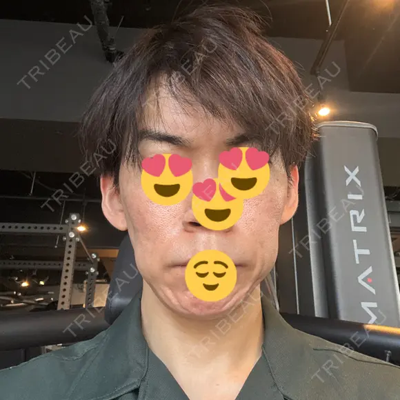 イオン導入 城本クリニック 新宿院 DAY 0 メイン用