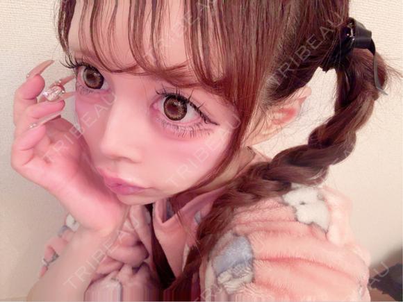 糸リフト / 水光注射（ハリ・美肌） ルラ美容クリニック 岡山院 AFTER メイン用