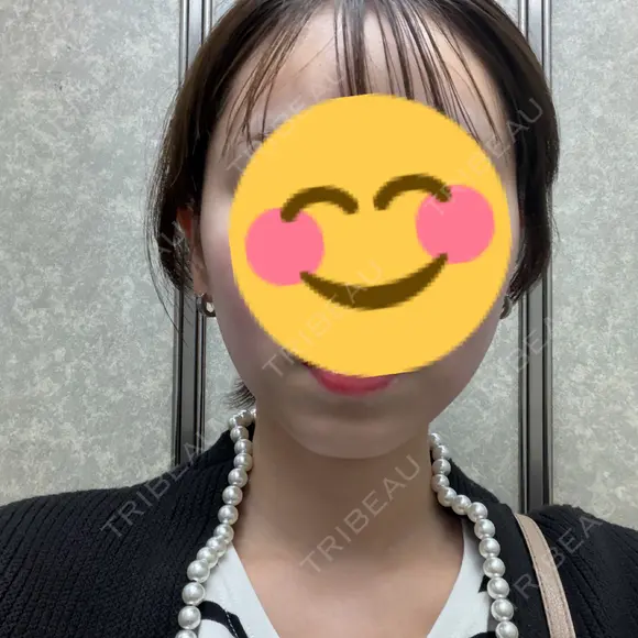 ハイフ（顔） HINATA クリニック DAY 0 メイン用