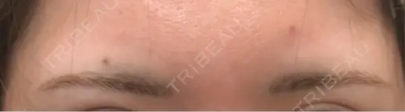 アートメイク（眉） APスキンクリニック銀座 DAY 7 メイン用