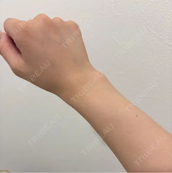 白玉点滴・注射 Aya Beauty & Family Clinic大阪院 DAY 0 メイン用