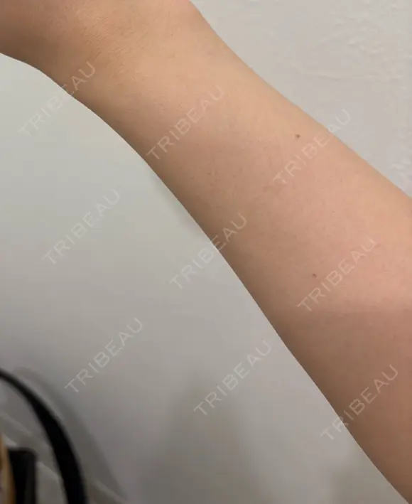 白玉点滴・注射 Aya Beauty & Family Clinic大阪院 AFTER メイン用