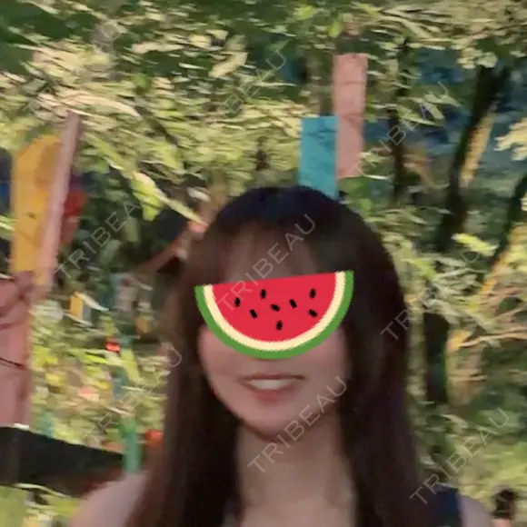 ハイフ（顔） HAAB×DREAM BEAUTY CLINIC 大阪梅田院 AFTER メイン用