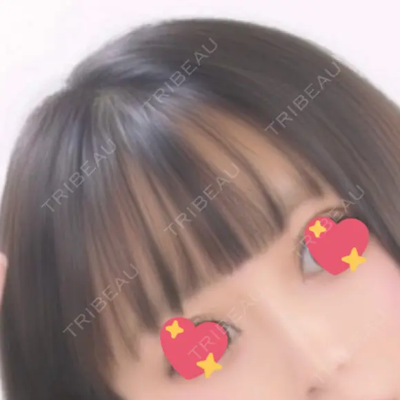 ヒアルロン酸注入（鼻） 広島プルミエクリニック AFTER メイン用