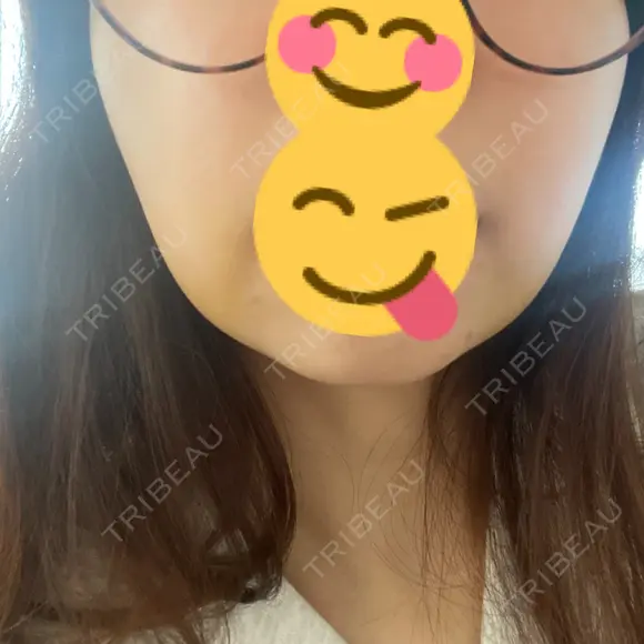 メーラーファット除去 / ジョールファット除去 R Beauty CLINIC 名古屋院 DAY 5 メイン用