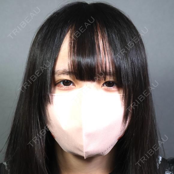 二重埋没 アリエル美容クリニック 郡山院 DAY 7 メイン用