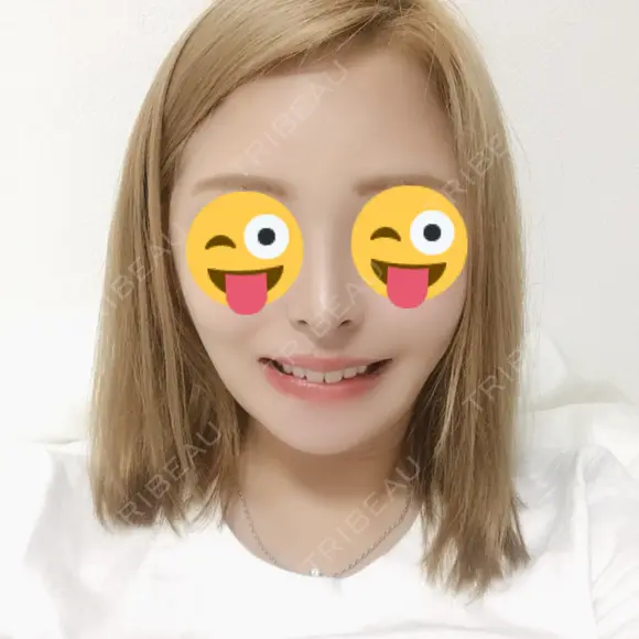 骨切り（あご） / 骨削り（エラ） / 骨削り（頬） / 脂肪吸引（顔） / ヒアルロン酸溶解 View美容整形外科 DAY 41 メイン用