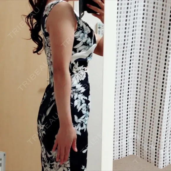 脂肪溶解注射（二の腕） 明洞トックスエンフィル DAY 9 メイン用