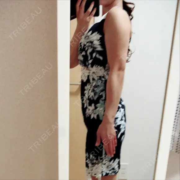 脂肪溶解注射（二の腕） 明洞トックスエンフィル DAY 9 メイン用