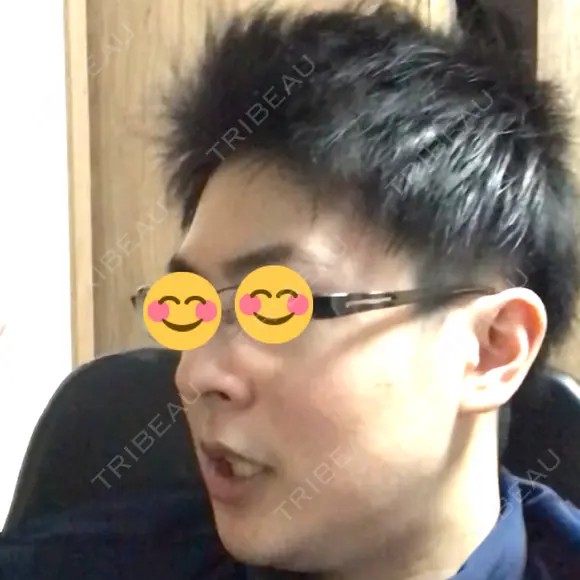 ほくろ・いぼ切除（肌） 大西皮フ科形成外科医院 京都四条烏丸院 DAY 196 メイン用