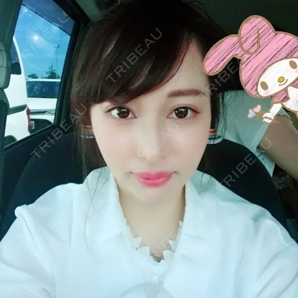 二重埋没 / 目頭切開 / 鼻尖形成（切開） / 鼻中隔延長（切開） / 軟骨移植 / ヒアルロン酸注入（鼻） / ヒアルロン酸注入（あご） 湘南美容クリニック 新潟院 DAY 90 メイン用
