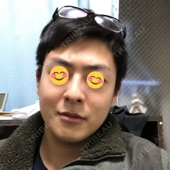 ほくろ・いぼ切除（肌） 吉田美容形成クリニック AFTER メイン用