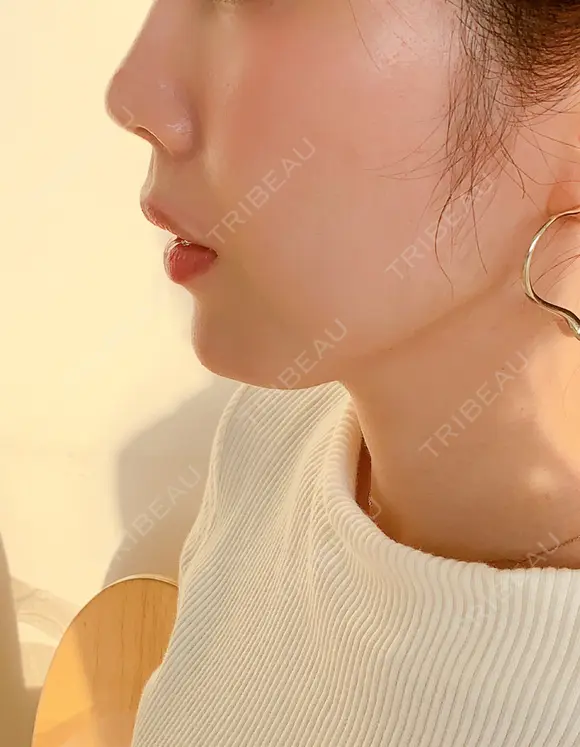 クマ治療 / 額を丸く / 脂肪吸引（脚） / レディエッセ注入（鼻） THE CLINIC（ザ・クリニック） 東京院 AFTER メイン用