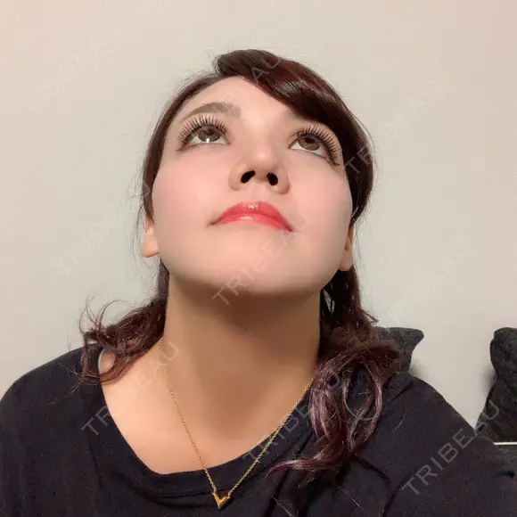 二重切開 / 目頭切開 / 眼瞼下垂（切開） / 軟骨移植 / 骨切幅寄せ / 斜鼻修正 id（アイディ）美容外科 DAY 33 メイン用