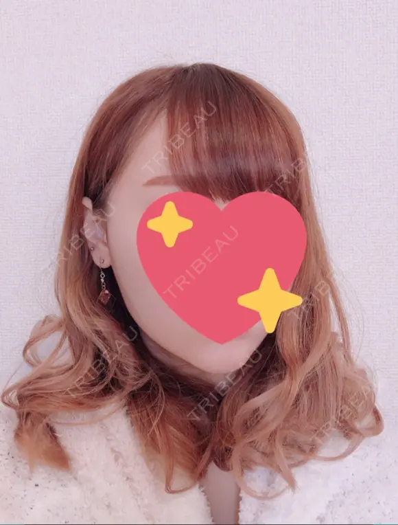 脂肪吸引（顔） / ボトックス（あご） / ボトックス（エラ・小顔） エートップ美容整形外科 DAY 269 メイン用