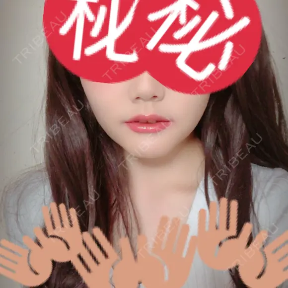 セットバック 大塚美容形成外科・歯科 大塚本院 DAY 23 メイン用