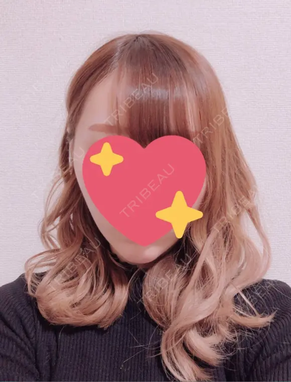 脂肪吸引（顔） / ボトックス（あご） / ボトックス（エラ・小顔） エートップ美容整形外科 DAY 280 メイン用