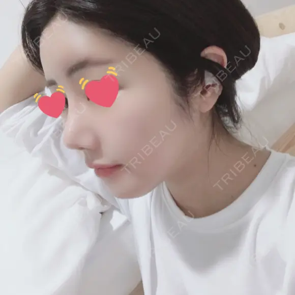 骨切り（あご） / 骨削り（エラ） / 骨削り（頬） / 脂肪吸引（顔） / 脂肪注入（額） / 脂肪溶解注射（顔） View美容整形外科 DAY 95 メイン用