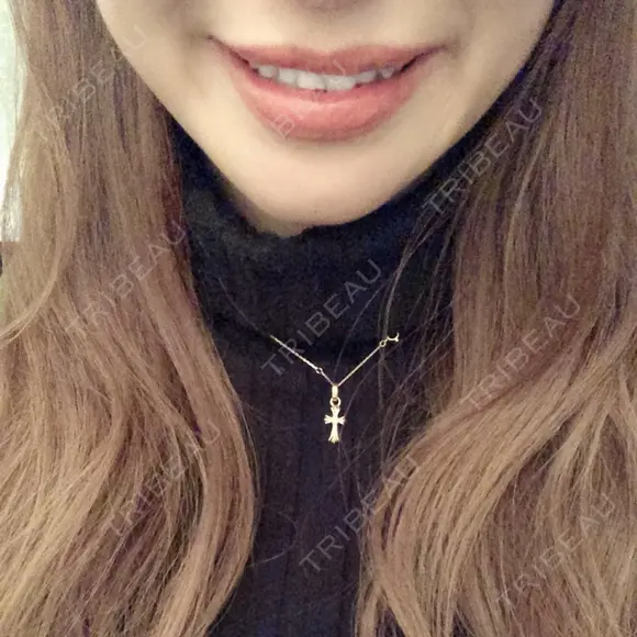 骨切り（あご） / 輪郭修正 / 脂肪溶解注射（顔） 心斎橋コムロ美容外科クリニック DAY 395 メイン用