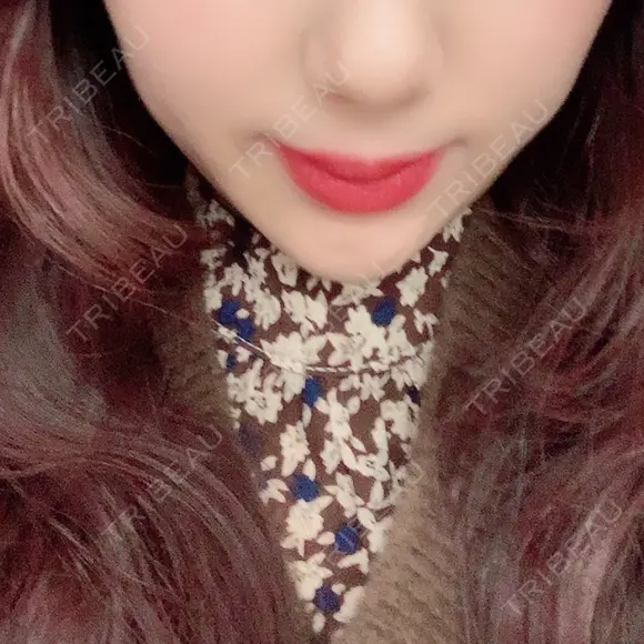 脂肪溶解注射（顔） クリニックA.O. DAY 59 メイン用