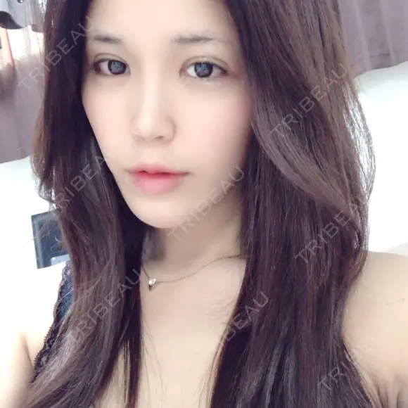 二重埋没 / 目頭切開 / 目尻切開 RG整形外科（旧リオン整形外科） DAY 27 メイン用