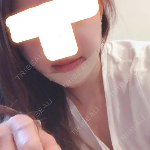 あごプロテーゼ / その他（輪郭） / セットバック / その他（審美歯科/矯正歯科） 大塚美容形成外科・歯科 大塚本院 AFTER メイン用
