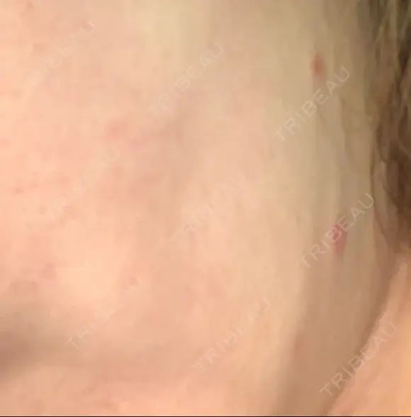 イオン導入 / 美肌レーザー / シミ取りレーザー / フォトRF / YAGレーザー / ニキビ治療 お肌のクリニック　高田馬場 AFTER メイン用