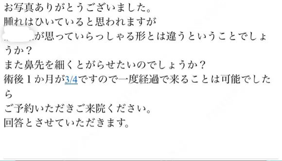 隆鼻術 たにまちクリニック DAY 26 メイン用