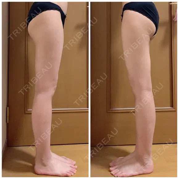 その他 GINI CLINIC（ジニクリニック） DAY 30 メイン用