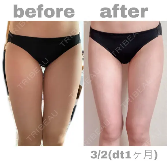 その他 GINI CLINIC（ジニクリニック） DAY 31 メイン用