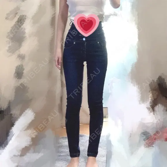 脂肪吸引（脚） / 豊胸（脂肪注入） / 脂肪溶解注射 ラインカルチャークリニック DAY 17 メイン用