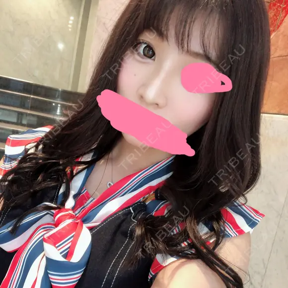 二重埋没 / 隆鼻術 共立美容外科 名古屋院 DAY 3 メイン用